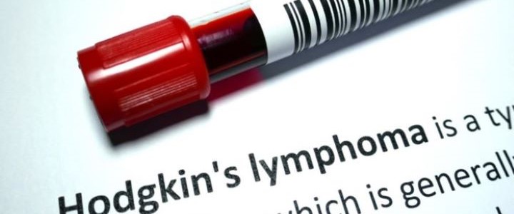 Mieux comprendre le lymphome de Hodgkin.