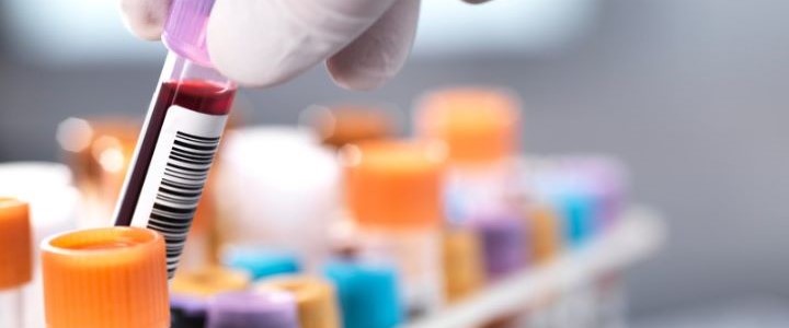 Les études observationnelles : quelques exemples en hématologie.